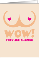 Wow! they are AMAZING! boob job surgery card
