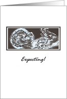 Announcing Pregnancy Illustration of Baby Ultrasound Scan card
